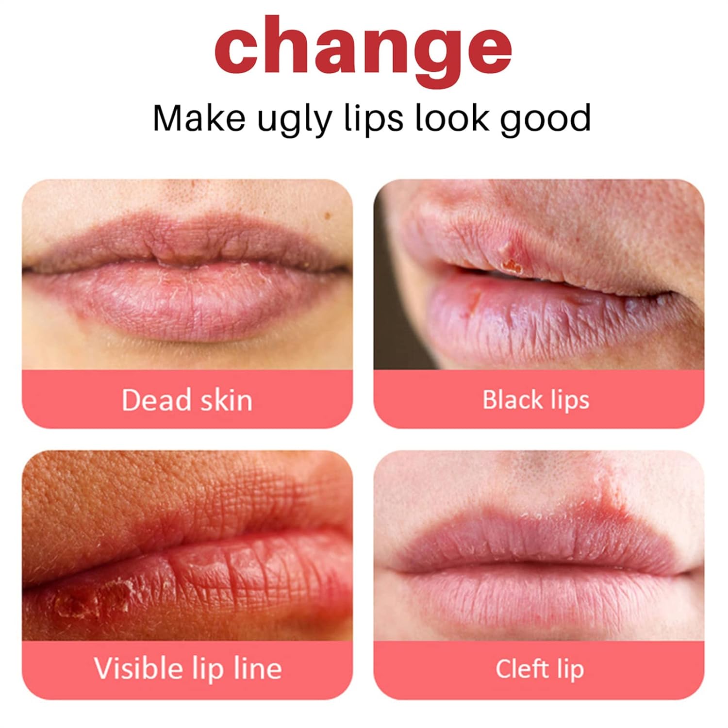 Crème Éclaircissante pour Lèvres Sombres - 3 pièces - ChoixGuinee